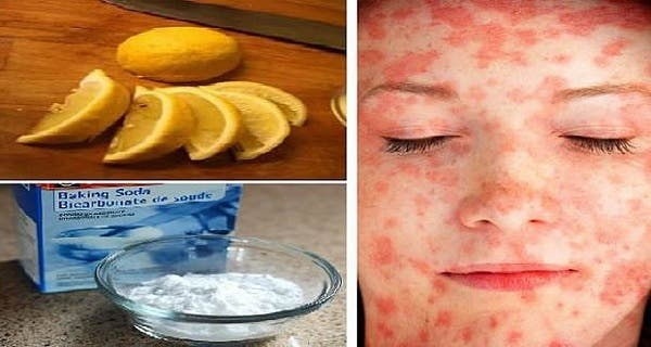 10 common products that destroy your skin (you will be completely disappointed by the 9th)