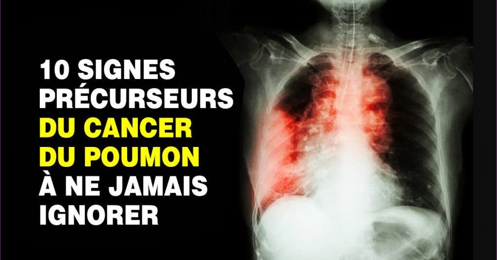 10 Signes Précurseurs Du Cancer Du Poumon Que Vous Devriez Connaitre