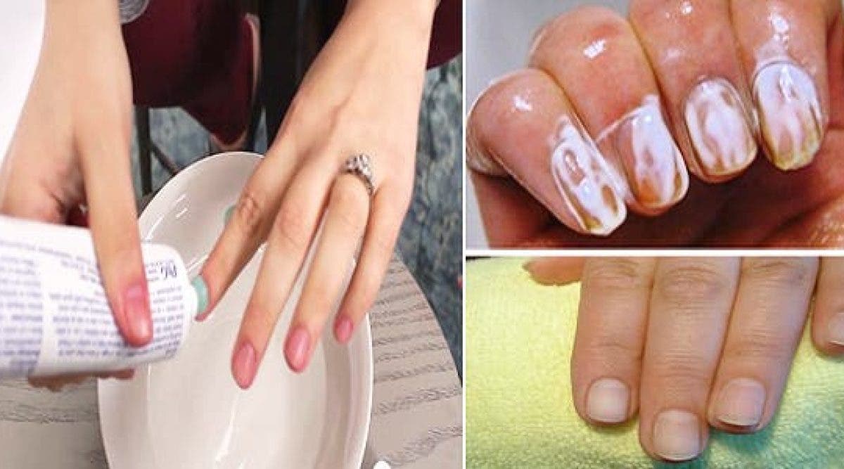 Frottez Du Dentifrice Sur Vos Ongles Pendant Quelques