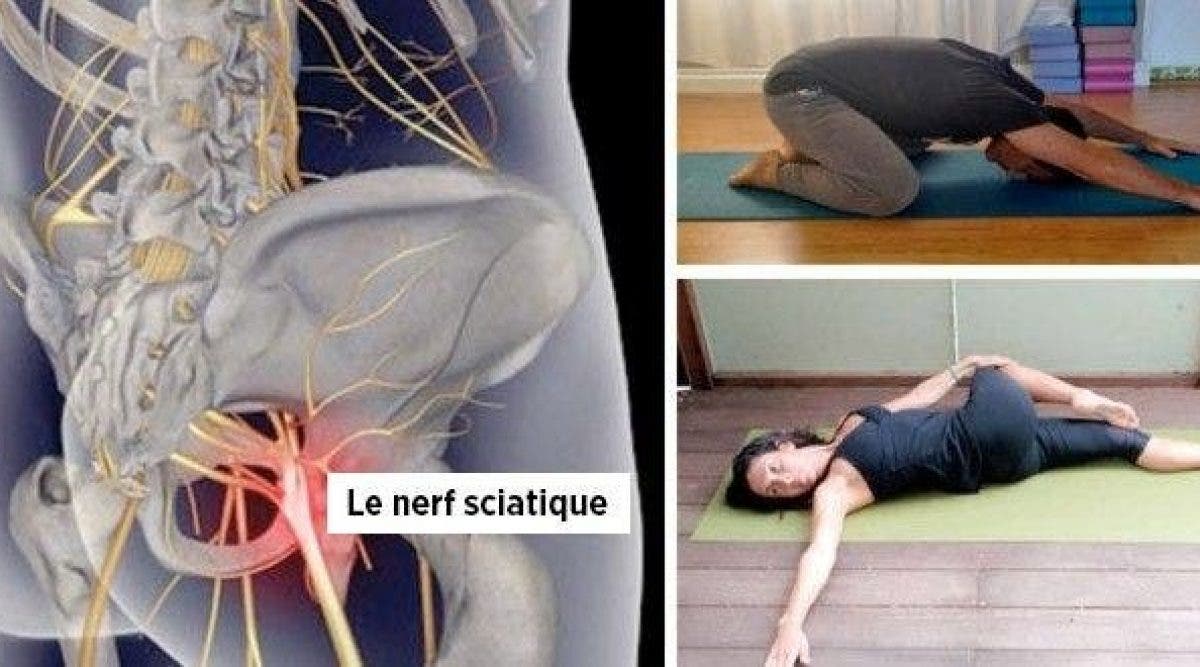 8 exercices de yoga pour soulager la douleur sciatique