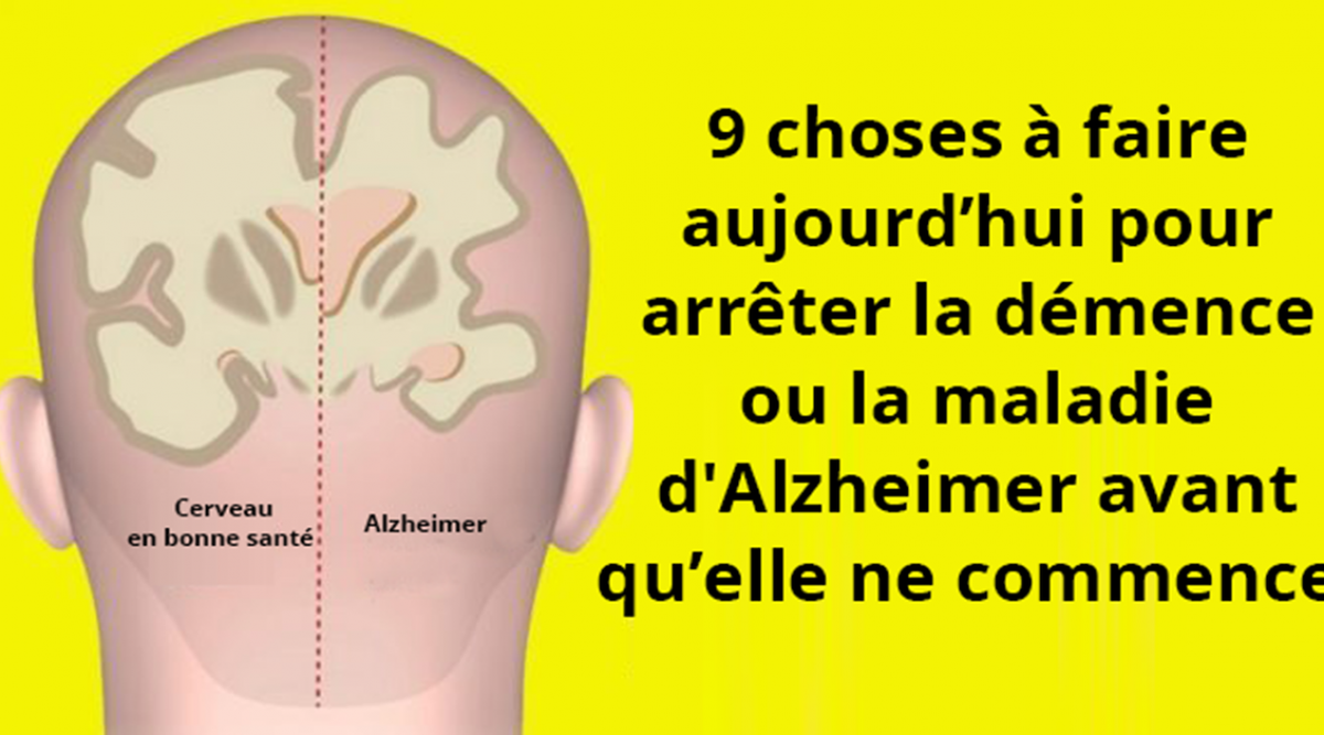 9 Choses à Faire Aujourd’hui Pour Arrêter La Démence Ou La Maladie D ...