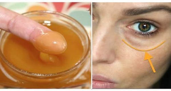 Apply this mask on your dark circles and make them disappear! Incredible results!