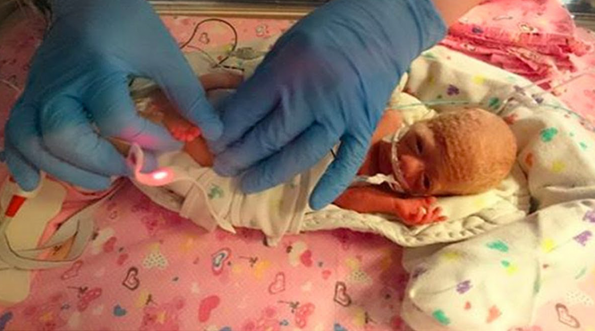 Ce Bebe Premature De 500 Grammes Est Fragile Et Mourant Le Medecin Lui Sauve La Vie Avec Un Sachet En Plastique De Supermarche