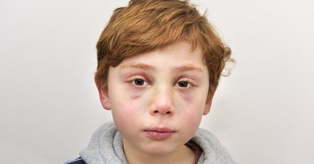 Cette petit garçon de 7 ans a été tué par ses parents