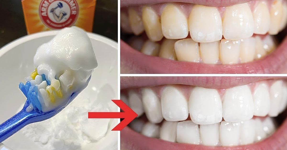Le bicarbonate de soude est-il bon pour les dents ?
