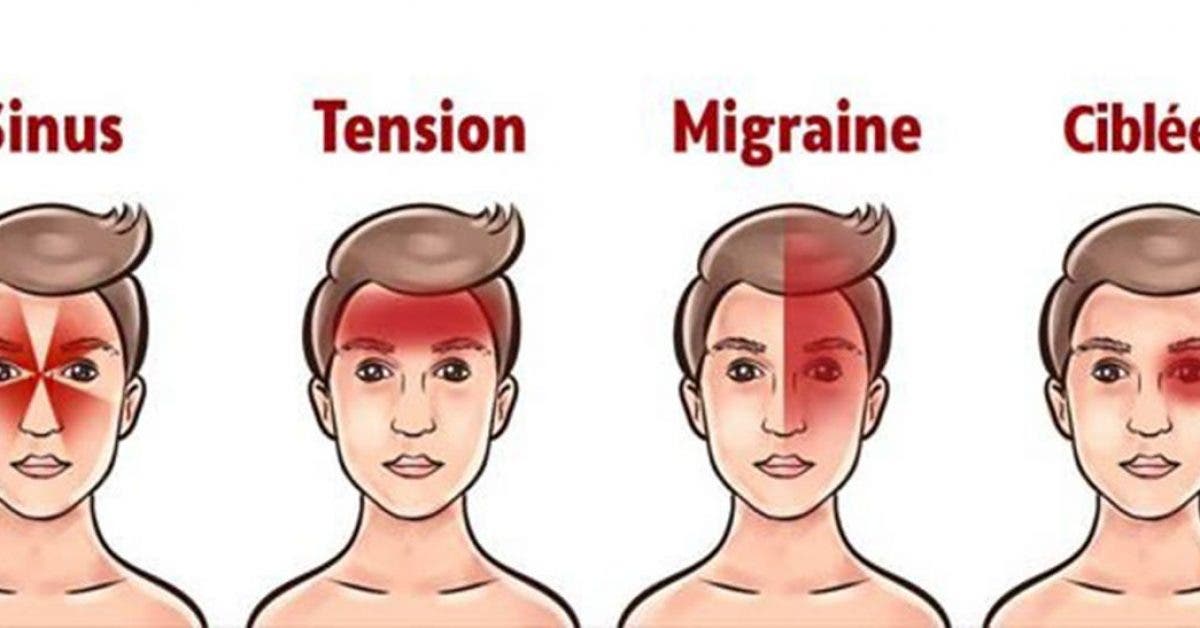 Débarrassez-vous d'un mal de tête en 5 minutes sans ...