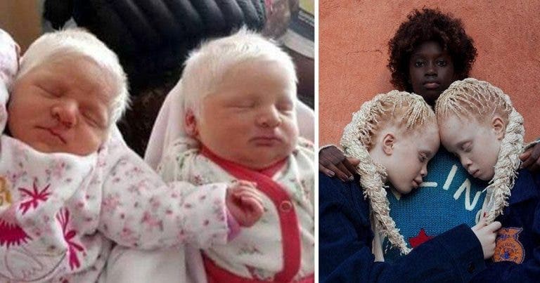 Des jumelles albinos émerveillent le monde avec leurs cheveux plus