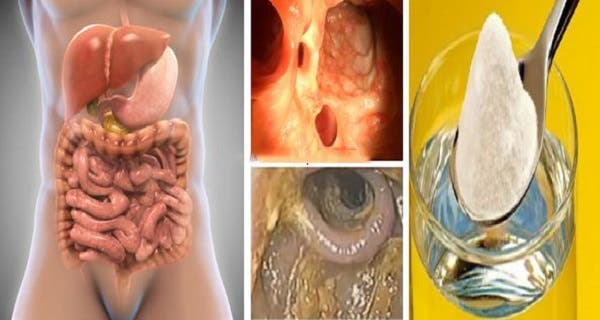 3-day detox of the colon, liver and lungs to remove toxins, grease, excess water and clean clogged arteries