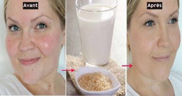 She washed her face with this solution twice a week for a month: the result is incredible!