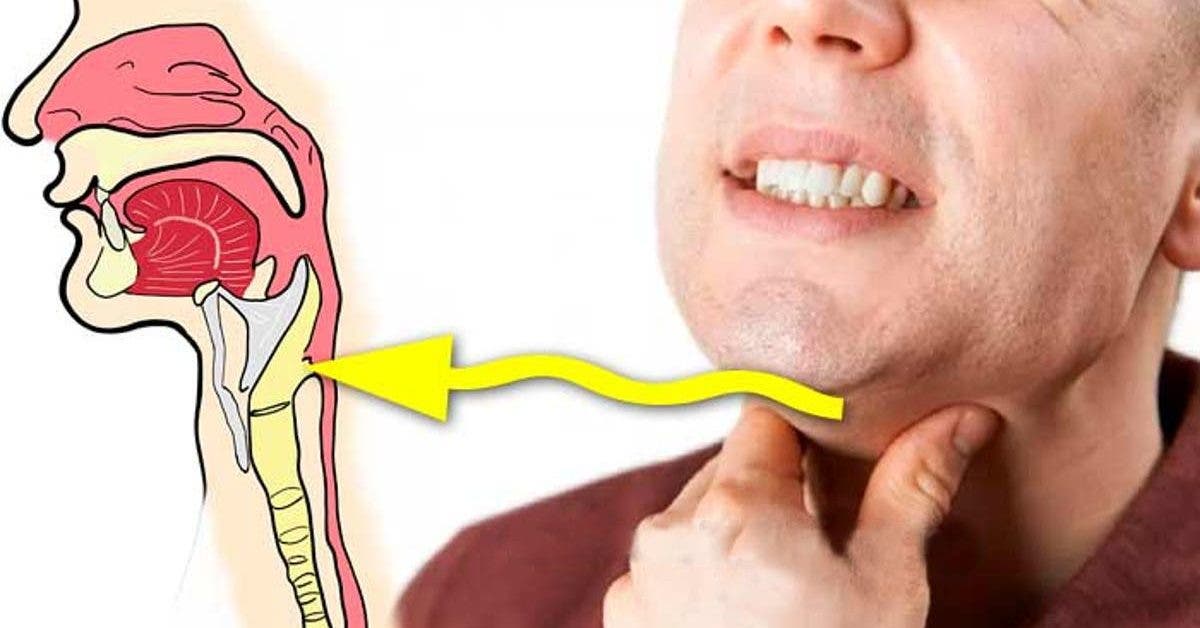 Arrêt Du Tabac Et Boule Dans La Gorge Boule dans la gorge. Les 7 causes principales et comment y remédier