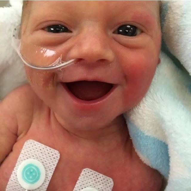 Le beau sourire de ce bébé prématuré donne de l’espoir aux parents de bébés prématurés