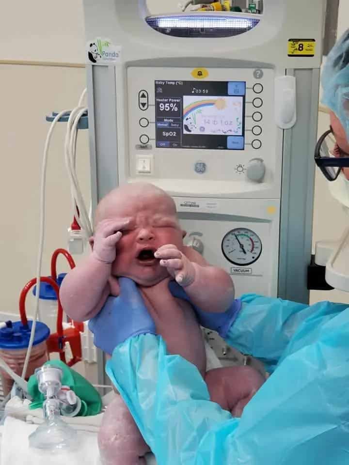 Le bébé Finnley à la naissance