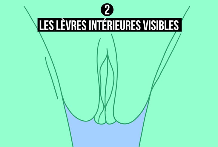 Lèvres intérieures visibles