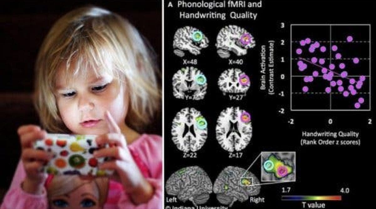 Quel Est Limpact Du Temps Pass Devant Un Cran Sur Le Cerveau Dun Hot Sex Picture 