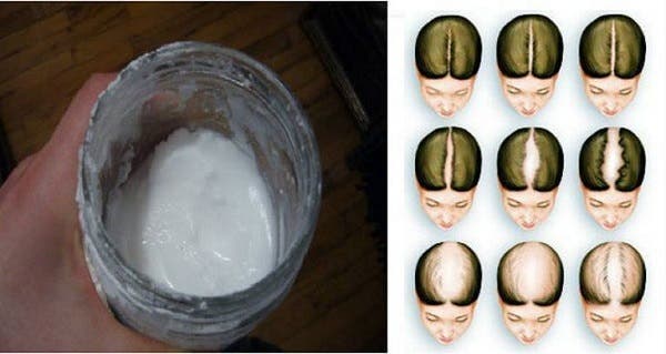 Recipe: Natural shampoo with baking soda to transform your hair!