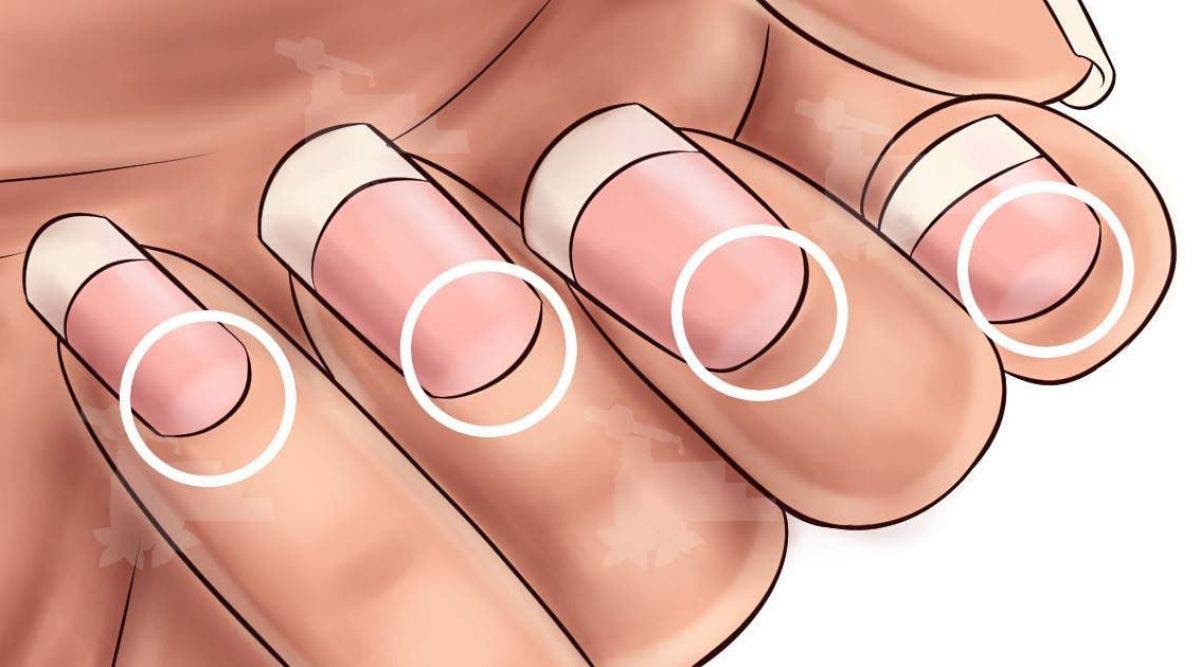 Voici Ce Que Révèlent Les Lunules Sur Vos Ongles