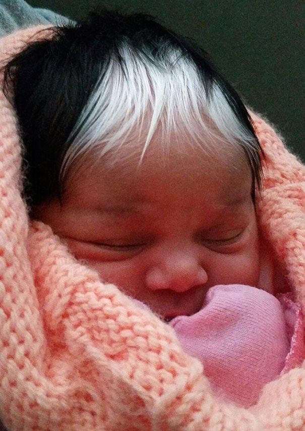 Un Bebe Est Ne Avec Des Cheveux Blancs Herites De Sa Maman Pensees Du Jour