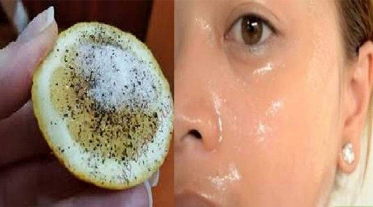 Une recette au citron pour effacer les taches du visage et avoir une peau éclatante