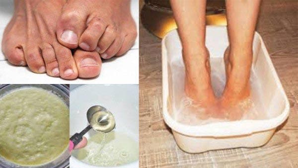 A powerful recipe for getting rid of the bad odor of the feet