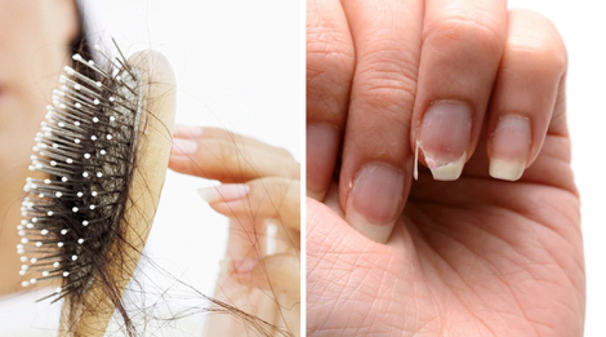 Voici Comment Arrêter La Chute De Cheveux Et Les Ongles