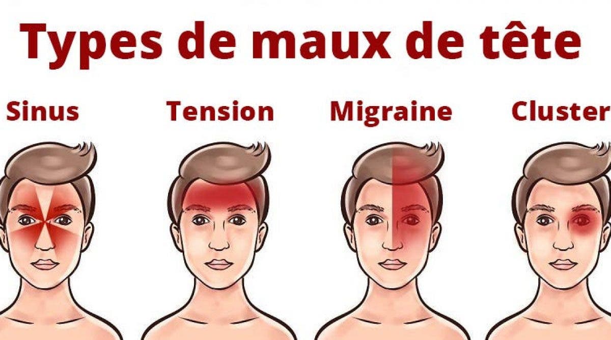 maux de tete tete lourde - tête lourde et fatigue