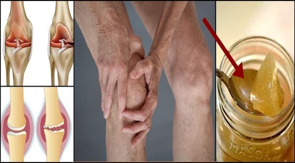 Here's how to regenerate the cartilage of the knee naturally