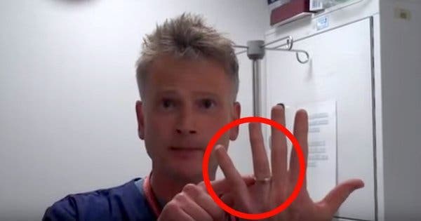 Do you have a ring stuck on your finger? With this doctor's trick, no need to worry!