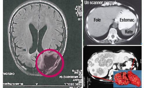 You consume daily this food that damages your brain and liver