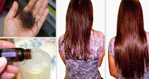 Add this to your hair shampoo to stop hair loss