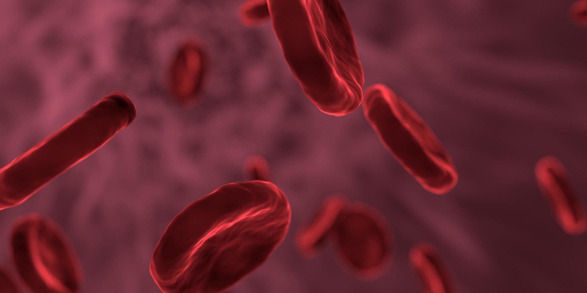 Symptômes, diagnostic, traitement : ce qu’il faut savoir sur la thrombose