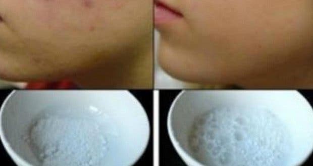 This natural recipe will smooth the facial features in only 5 minutes!