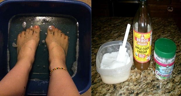 This powerful recipe relieves joint pain and arthritis