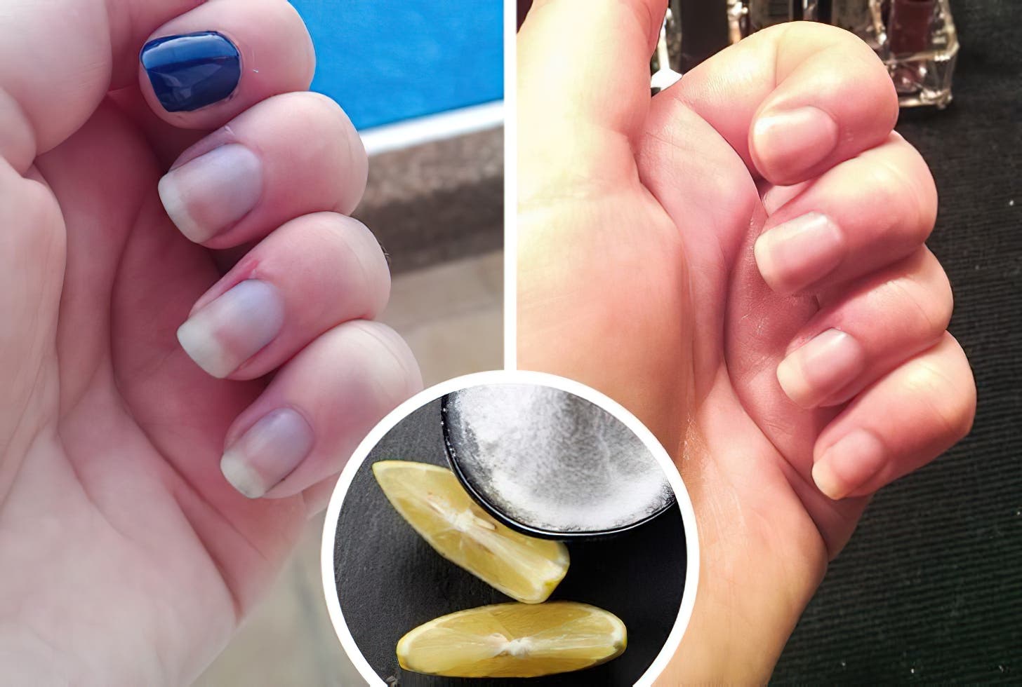 10 Remedes Maison Qui Peuvent Faire Des Merveilles Pour Vos Ongles