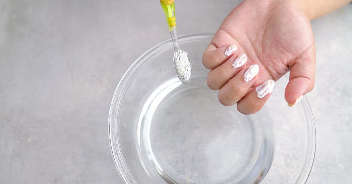 Comment blanchir les ongles : 7 astuces pour enlever le jaunissement