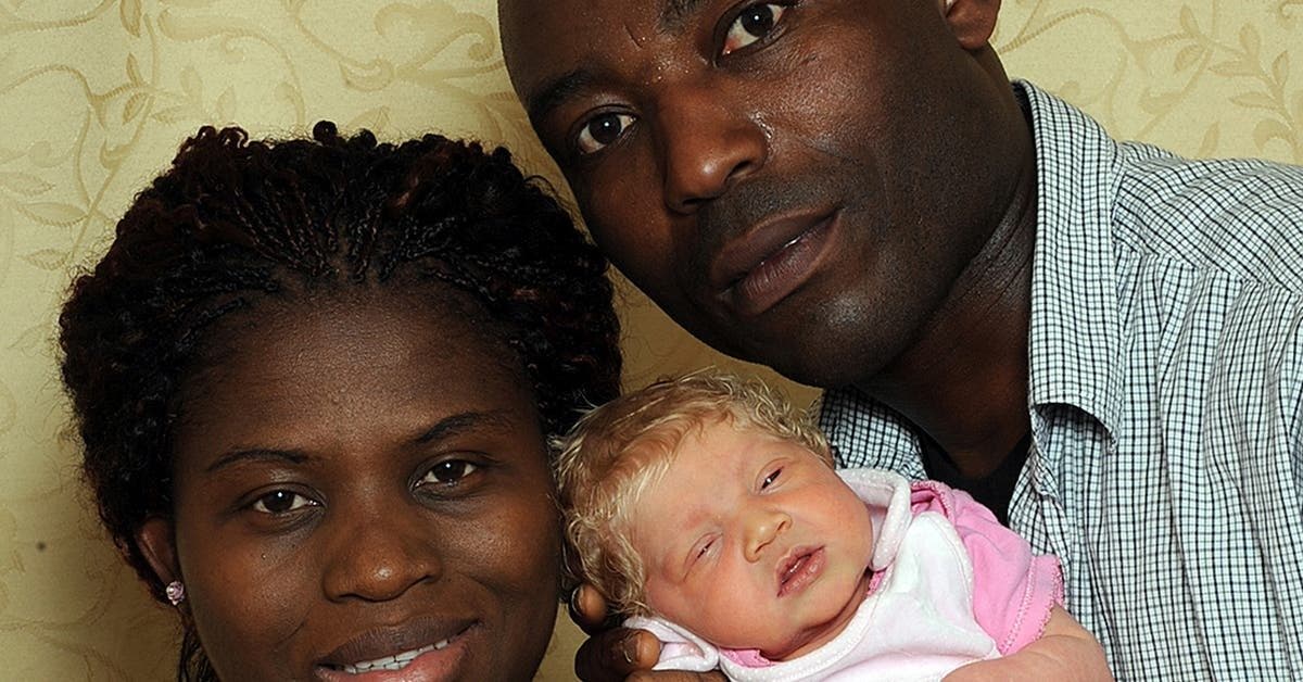 Des Parents Noirs Donnent Naissance A Un Bebe Blanc Aux Yeux Bleus Decouvrez Les