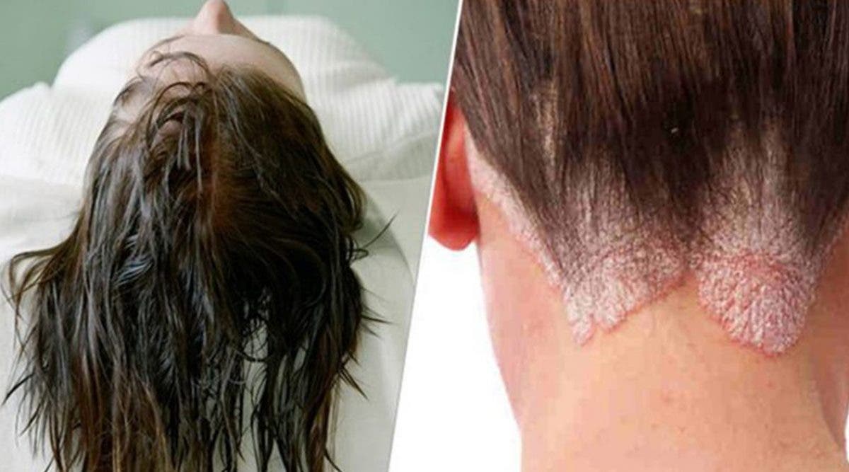 Dormir avec les cheveux mouillés peut provoquer 7 maladies différentes