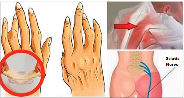 A great trick to relieve arthritis, sciatic pain and back pain