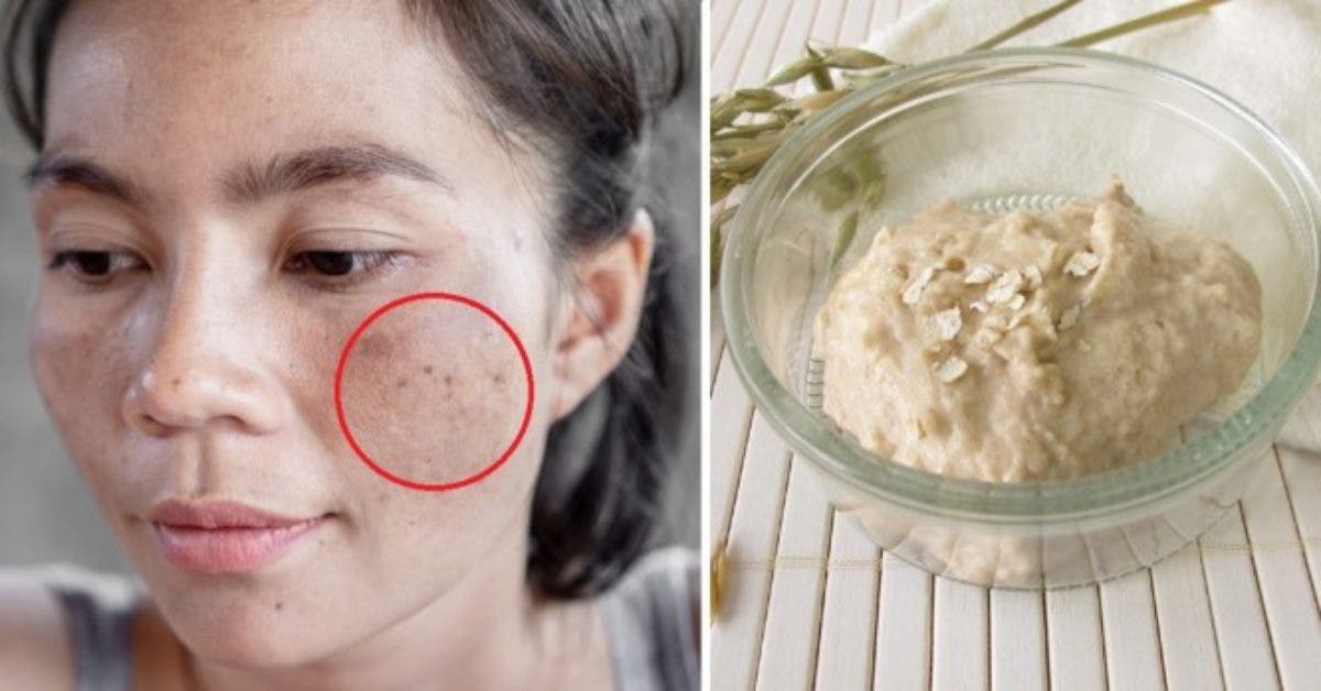 Astuces Naturels Pour Resserrer Les Pores Dilat S Et Avoir Une Peau