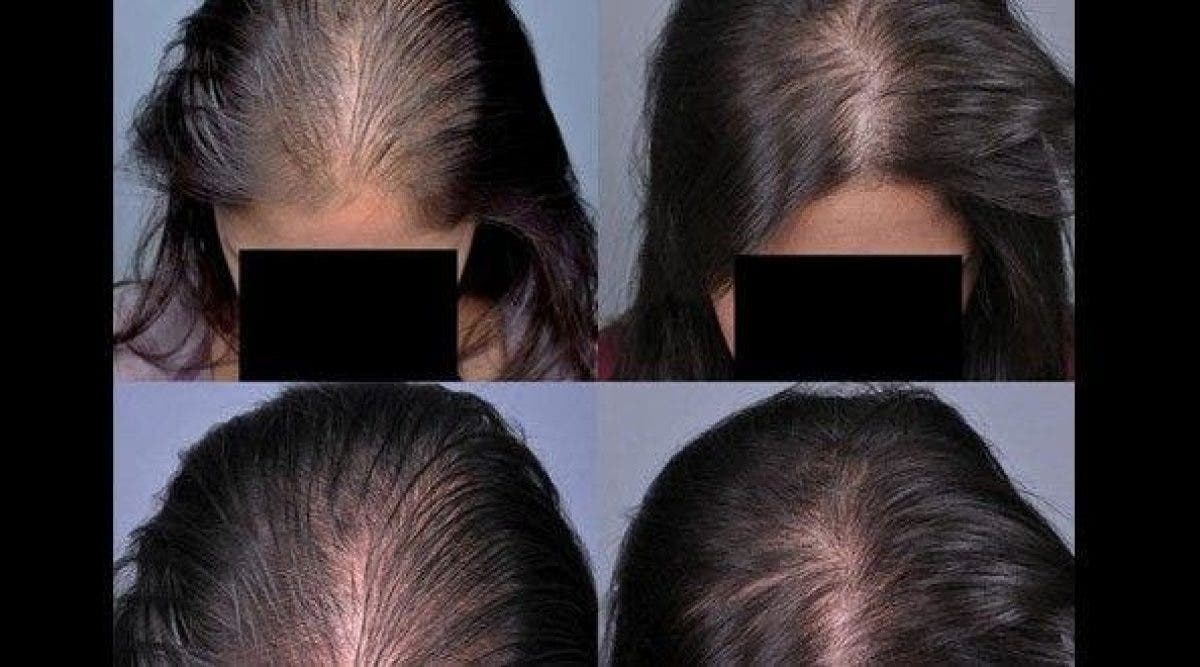 Le secret beauté des Indiennes pour faire pousser les cheveux