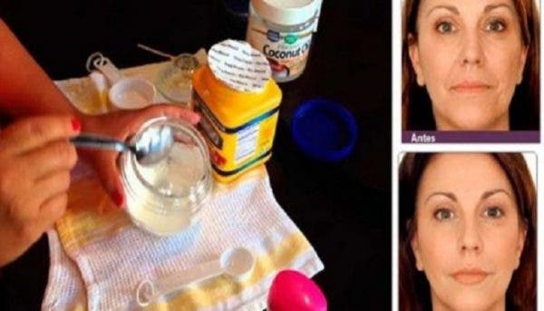 This woman used this incredible homemade cream for a week and 50% of the wrinkles on her face disappeared miraculously (Recipe)