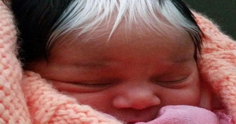 À quoi ressemble maintenant la maman du bébé aux cheveux blancs dont la