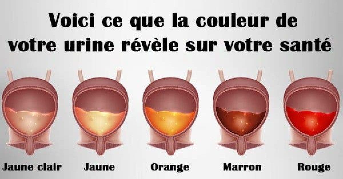 Vérifiez la couleur de votre urine