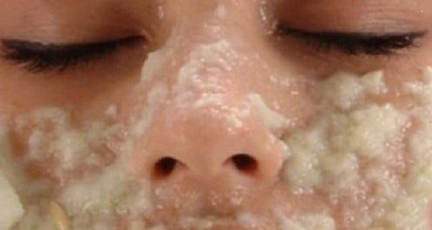 Here's how to remove brown spots from your face