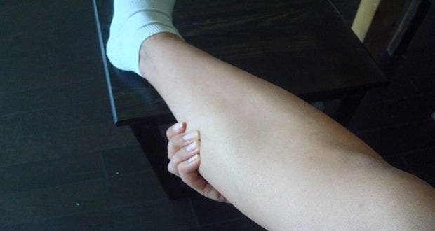 Here's how to prevent cramps in the legs and never have them again