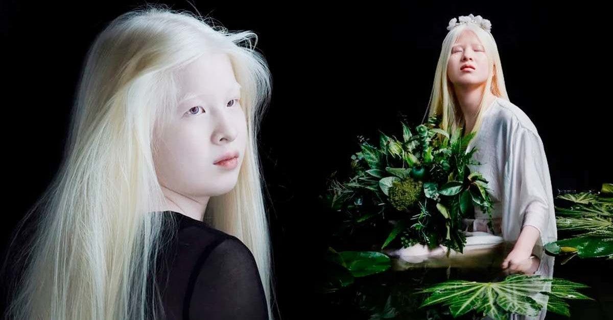 Xueli Abbing : Mannequin albinos qui redéfinit la beauté et brise les stéréotypes